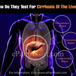 Do i have cirrhosis quiz